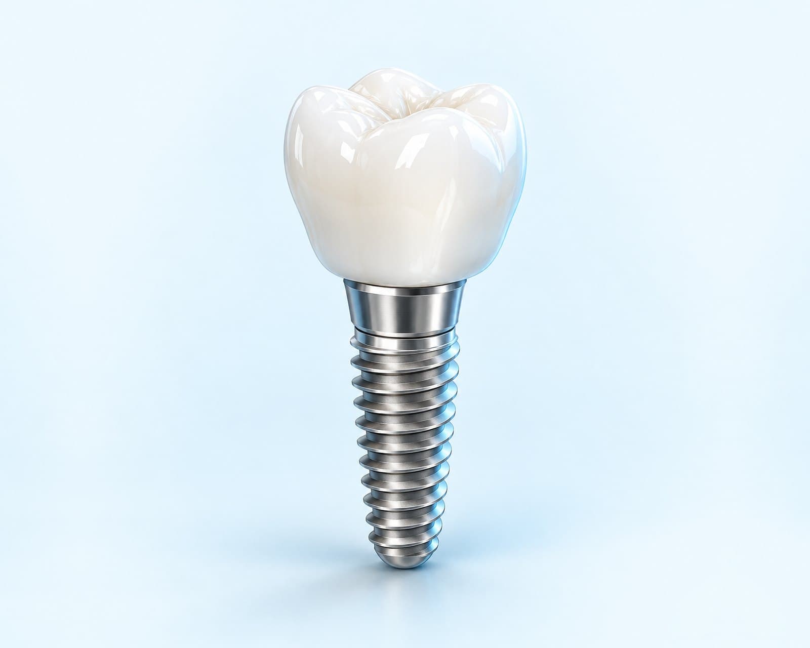 Illustrative rendering of a dental implant and tooth-colored crown