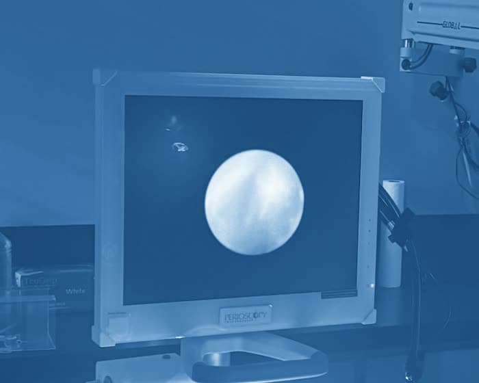 The periodontal endoscope monitor at Perio One, showing a magnified view of a tooth root