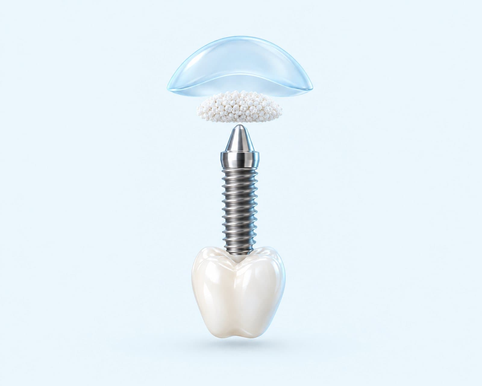 Illustrative rendering of an implant beneath a translucent dome with a cushion of graft material between