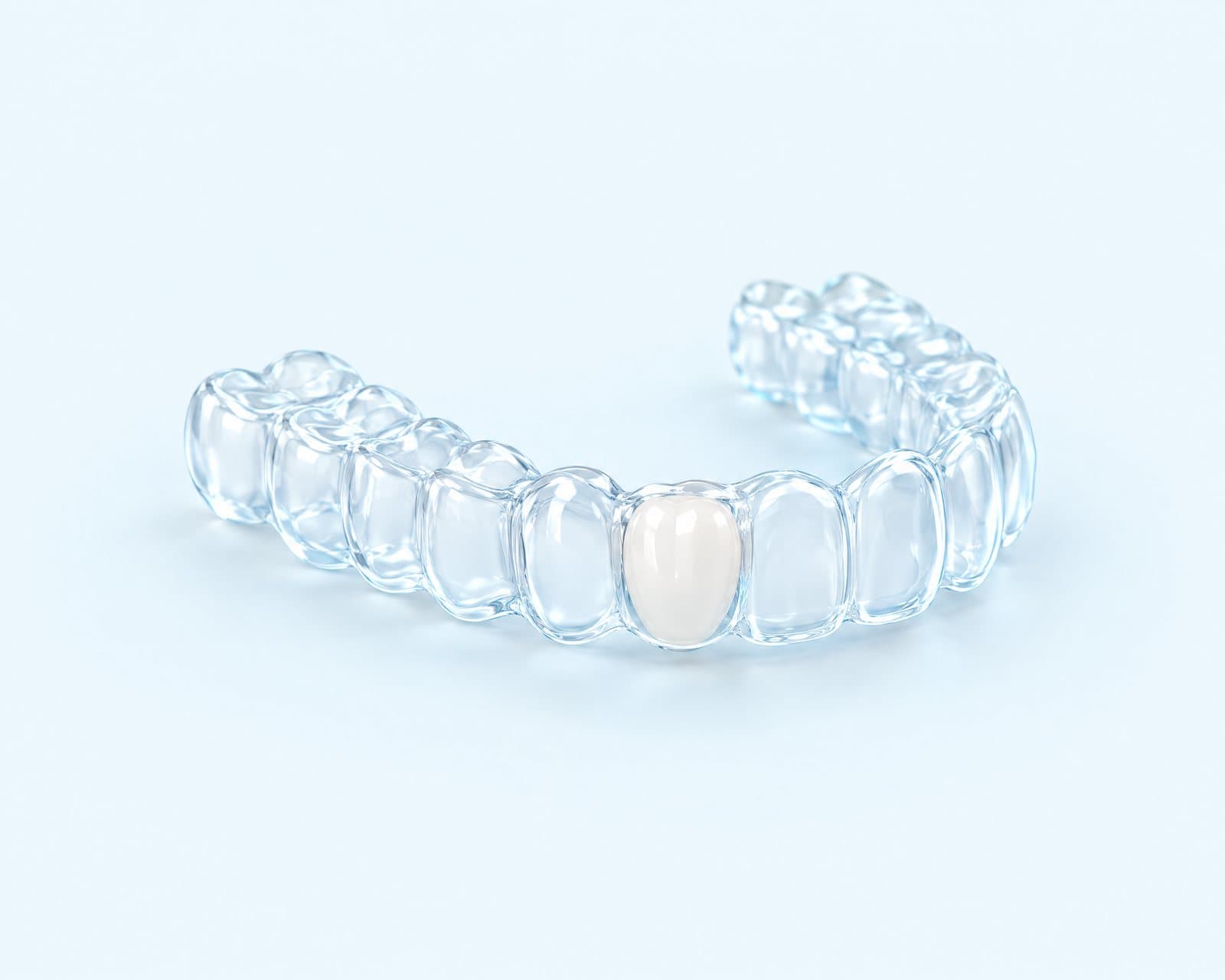 Illustrative rendering of a clear tray holding a single replacement tooth